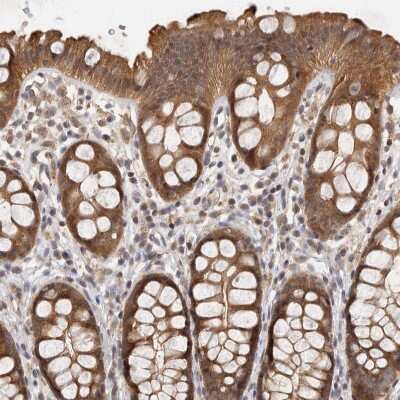 Immunohistochemistry-Paraffin: ACAT2 Antibody [NBP1-85967]