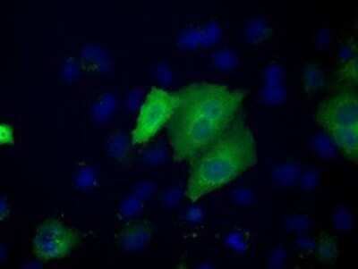 Immunocytochemistry/ Immunofluorescence: ACAT2 Antibody (OTI3E2) - Azide and BSA Free [NBP2-70068]