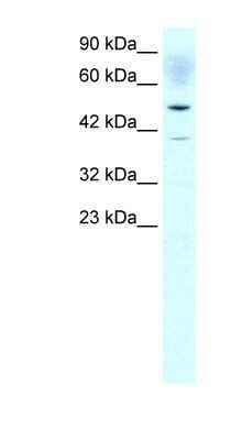 Western Blot: ACAT2 Antibody [NBP1-54616]