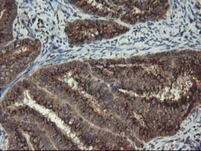 Immunohistochemistry: ACBD3 Antibody (OTI1G2) [NBP2-46478]