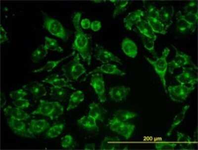 Immunocytochemistry/ Immunofluorescence: ACBD3 Antibody (2G2) [H00064746-M01]