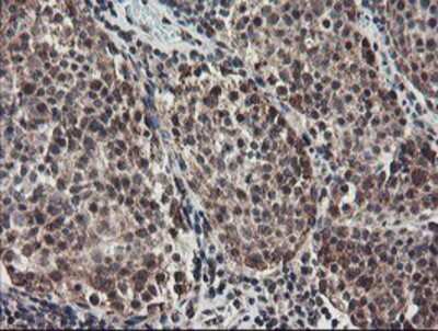 Immunohistochemistry-Paraffin: ACBD3 Antibody (OTI3A1) [NBP2-03720]