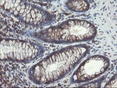 Immunohistochemistry: ACBD3 Antibody (OTI1G2) - Azide and BSA Free [NBP2-72148]