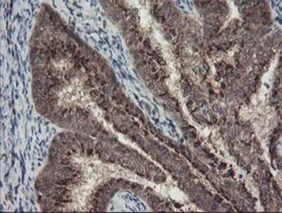 Immunohistochemistry: ACBD3 Antibody (OTI3A1) - Azide and BSA Free [NBP2-72149]