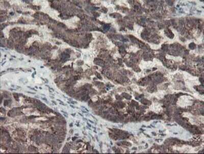 Immunohistochemistry: ACBD3 Antibody (OTI3A1) - Azide and BSA Free [NBP2-72149]