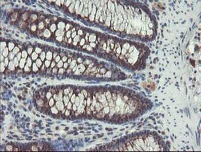 Immunohistochemistry: ACBD3 Antibody (OTI3A1) - Azide and BSA Free [NBP2-72149]