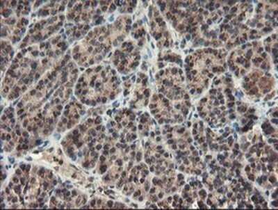 Immunohistochemistry: ACBD3 Antibody (OTI3A1) - Azide and BSA Free [NBP2-72149]