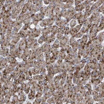 Immunohistochemistry-Paraffin: ACBD4 Antibody [NBP2-14258]