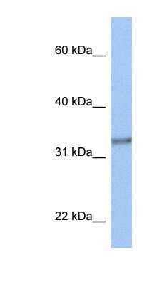 Western Blot: ACBD4 Antibody [NBP1-59830]