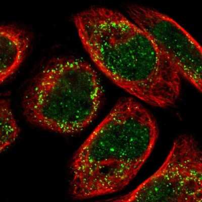 Immunocytochemistry/ Immunofluorescence: ACBD5 Antibody [NBP1-85145]