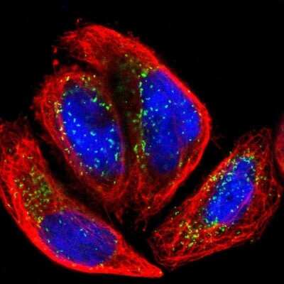 Immunocytochemistry/ Immunofluorescence: ACBD5 Antibody [NBP1-85146]