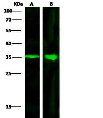 Western Blot: ACBD6 Antibody (4A9D5E9) [NBP3-06614]