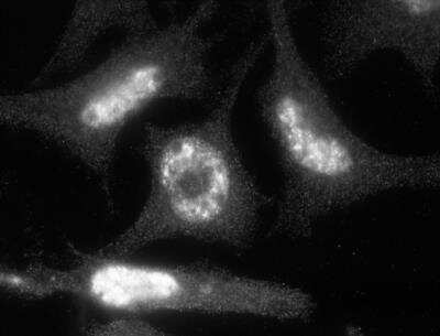 Immunocytochemistry/ Immunofluorescence: ACBD7 Antibody [NBP1-56527]