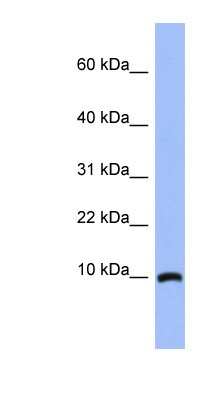 Western Blot: ACBD7 Antibody [NBP1-56527]