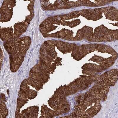Immunohistochemistry-Paraffin: ACBP Antibody [NBP2-38648]