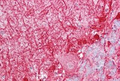Immunohistochemistry-Paraffin: ACBP Antibody [NBP1-54806]