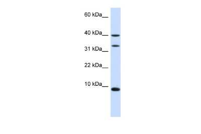 Western Blot: ACBP Antibody [NBP1-54806]