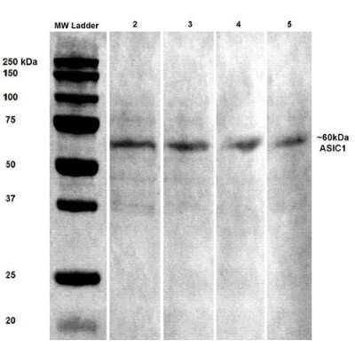 Western Blot: ACCN2 Antibody (S271-44) [NBP2-22409]