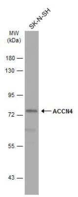 Western Blot: ACCN4 Antibody [NBP2-15241]
