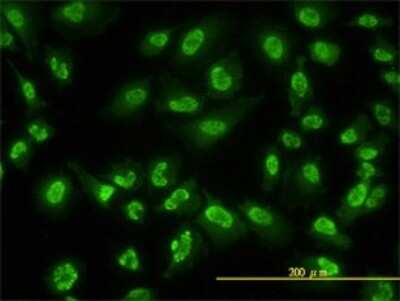 Immunocytochemistry/ Immunofluorescence: ACD Antibody (1D8-1B6) [H00065057-M02]