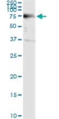 Immunoprecipitation: ACD Antibody (1D8-1B6) [H00065057-M02]