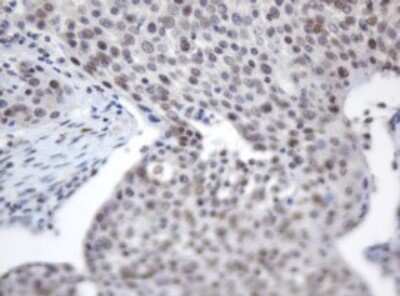 Immunohistochemistry: ACD Antibody (OTI2B1) [NBP2-45475]