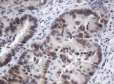Immunohistochemistry: ACD Antibody (OTI2B1) - Azide and BSA Free [NBP2-72169]
