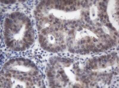 Immunohistochemistry: ACD Antibody (OTI2B1) - Azide and BSA Free [NBP2-72169]