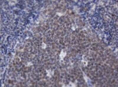 Immunohistochemistry: ACD Antibody (OTI2B1) - Azide and BSA Free [NBP2-72169]