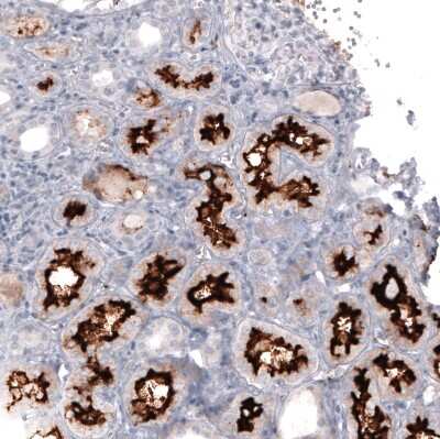 Immunohistochemistry-Paraffin: ACE-2 Antibody (CL4013) [NBP2-59036]