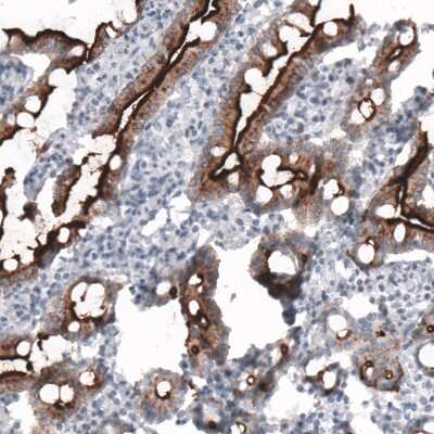 Immunohistochemistry-Paraffin: ACE-2 Antibody (CL4013) [NBP2-59036]