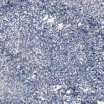 Immunohistochemistry-Paraffin: ACE-2 Antibody (CL4013) [NBP2-59036]