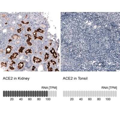 Immunohistochemistry-Paraffin: ACE-2 Antibody (CL4013) [NBP2-59036]