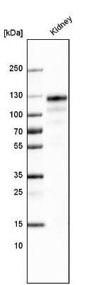 Western Blot: ACE-2 Antibody (CL4013) [NBP2-59036]