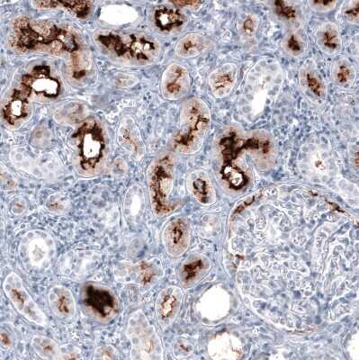 Immunohistochemistry-Paraffin: ACE-2 Antibody (CL4035) [NBP2-59037]