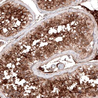Immunohistochemistry-Paraffin: ACE-2 Antibody (CL4035) [NBP2-59037]