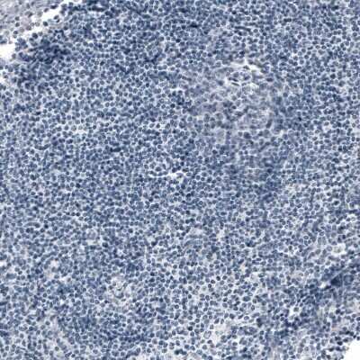 Immunohistochemistry-Paraffin: ACE-2 Antibody (CL4035) [NBP2-59037]