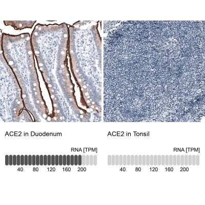 Immunohistochemistry-Paraffin: ACE-2 Antibody (CL4035) [NBP2-59037]