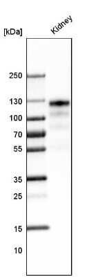 Western Blot: ACE-2 Antibody (CL4035) [NBP2-59037]