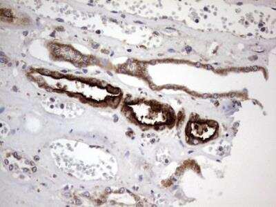 Immunohistochemistry-Paraffin: ACE-2 Antibody (OTI4D2) - Azide and BSA Free [NBP2-72117]