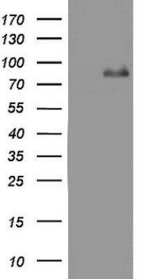 Western Blot: ACE-2 Antibody (OTI4D2)Azide and BSA Free [NBP2-72117]