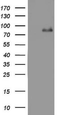 Western Blot: ACE-2 Antibody (OTI4D2) [NBP2-46490]