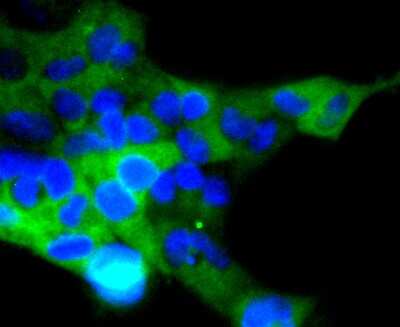 Immunocytochemistry/ Immunofluorescence: ACE-2 Antibody (SN0754) [NBP2-67692]
