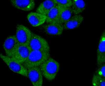 Immunocytochemistry/ Immunofluorescence: ACE-2 Antibody (SN0754) [NBP2-67692]