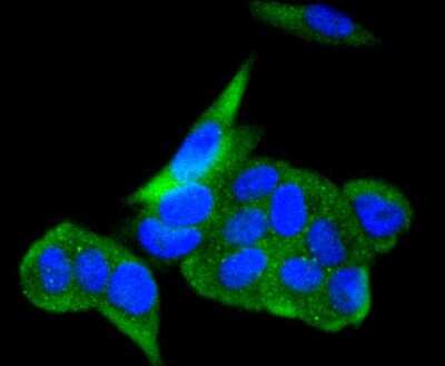 Immunocytochemistry/ Immunofluorescence: ACE-2 Antibody (SN0754) [NBP2-67692]