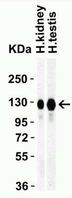 Western Blot: ACE-2 AntibodyBSA Free [NBP1-76611]