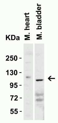 Western Blot: ACE-2 AntibodyBSA Free [NBP1-76611]