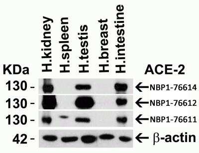 Western Blot: ACE-2 AntibodyBSA Free [NBP1-76611]