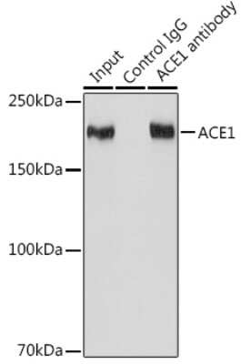 Immunoprecipitation: ACE/CD143 Antibody (1C9J3) [NBP3-15373]