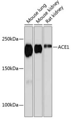 Western Blot: ACE/CD143 Antibody (1C9J3) [NBP3-15373]